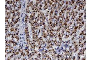 Image no. 1 for anti-Acetyl-CoA Acyltransferase 1 (ACAA1) (AA 217-316) antibody (ABIN599345) (ACAA1 anticorps  (AA 217-316))