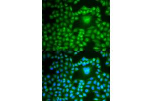 Immunofluorescence analysis of U2OS cell using PPP1CB antibody.