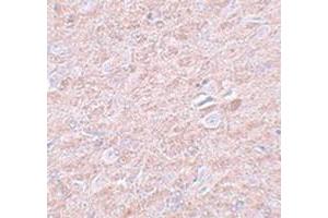 Immunohistochemical staining of rat brain tissue with PRDM16 polyclonal antibody  at 25 ug/mL dilution.