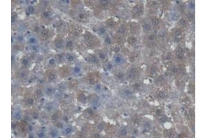 DAB staining on IHC-P; Samples: Rat Liver Tissue (AGXT anticorps  (AA 182-371))