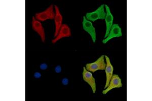 ABIN7096982 and ABIN7101049 staining Hela cells by IF/ICC. (PROZ anticorps)