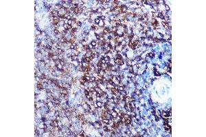 Immunohistochemistry of paraffin-embedded rat spleen using HLA-DQ Rabbit mAb (1252) at dilution of 1:100 (40x lens). (HLA-DQA1 anticorps)
