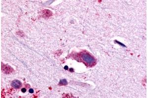 Anti-NTSR1 antibody  ABIN1049156 IHC staining of human brain, neurons and glia. (NTSR1 anticorps  (C-Term))