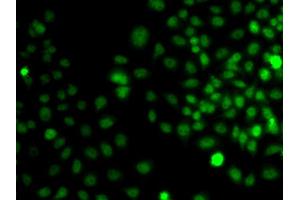 Immunofluorescence analysis of A549 cell using TRPS1 antibody. (TRPS1 anticorps)