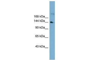 WB Suggested Anti-WDR35 Antibody Titration: 0. (WDR35 anticorps  (N-Term))