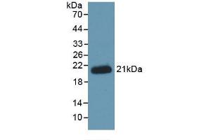 Western blot analysis of recombinant Human HJV. (HFE2 anticorps  (AA 234-416))