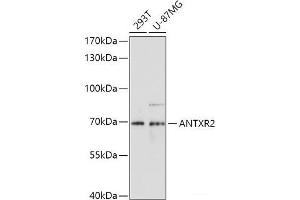 Western blot analysis of extracts of various cell lines using ANTXR2 Polyclonal Antibody at dilution of 1:1000.