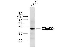 Lovo lysates probed with C2orf53 Polyclonal Antibody, Unconjugated  at 1:300 dilution and 4˚C overnight incubation.