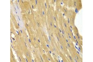 Immunohistochemistry of paraffin-embedded Mouse heart using AK1 Polyclonal Antibody at dilution of 1:100 (40x lens).