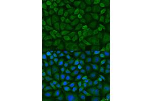 Immunofluorescence analysis of U2OS cells using MT-CO1 antibody (ABIN2561977) at dilution of 1:100. (COX1 anticorps)