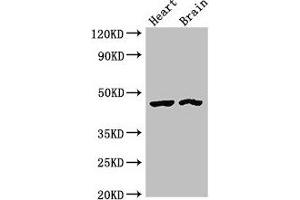 Western Blot Positive WB detected in: Rat heart tissue, Mouse brain tissue All lanes: CTH antibody at 4 μg/mL Secondary Goat polyclonal to rabbit IgG at 1/50000 dilution Predicted band size: 45, 40, 42 kDa Observed band size: 45 kDa (CTH anticorps  (AA 1-70))
