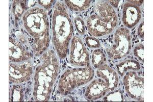 Image no. 2 for anti-Parvin, alpha (PARVA) antibody (ABIN1496442)