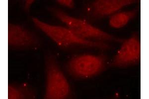 Immunofluorescence staining of methanol-fixed HeLa cells using c-Abl (phospho-Tyr412) antibody.