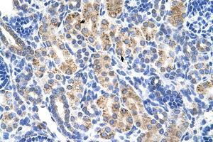 Image no. 1 for anti-Aldehyde Dehydrogenase 3 Family, Member A2 (ALDH3A2) (AA 351-400) antibody (ABIN6736668)