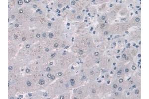 Detection of FABP1 in Human Liver Tissue using Monoclonal Antibody to Fatty Acid Binding Protein 1 (FABP1)