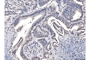 IHC analysis of TPR using anti-TPR antibody (ABIN7603243). (TPR anticorps  (N-Term))