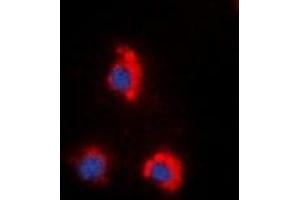 Immunofluorescent analysis of ZAP70 (pY319) staining in HeLa cells. (ZAP70 anticorps  (pTyr319))