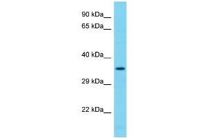 Host: Rabbit Target Name: NDUFAF7 Sample Type: 293T Whole Cell lysates Antibody Dilution: 1. (NDUFAF7 anticorps  (C-Term))