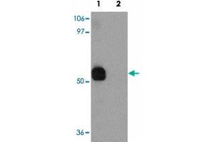 Western blot analysis of SPTLC2 in NIH/3T3 cell lysate with SPTLC2 polyclonal antibody  at 1 ug/mL in (1) the absence and (2) the presence of blocking peptide.