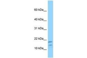 Image no. 1 for anti-Diazepam Binding Inhibitor (DBI) (N-Term) antibody (ABIN6748198) (Diazepam Binding Inhibitor anticorps  (N-Term))
