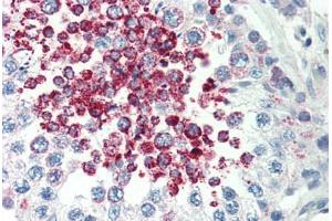 Human Testis (formalin-fixed, paraffin-embedded) stained with CARD10 antibody ABIN214428 at 5 ug/ml followed by biotinylated goat anti-rabbit IgG secondary antibody ABIN481713, alkaline phosphatase-streptavidin and chromogen. (CARD10 anticorps  (C-Term))