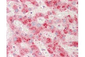 Anti-ADAMTS13 antibody IHC staining of human liver.