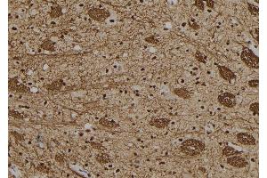 ABIN6279449 at 1/100 staining Rat brain tissue by IHC-P. (Gon-4-Like anticorps  (N-Term))