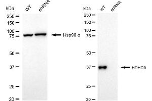 Western blotting analysis using HDHD5 antibody (ABIN7798836). (Recombinant Haloacid Dehalogenase-Like Hydrolase Domain-Containing 5 (HDHD5) anticorps)