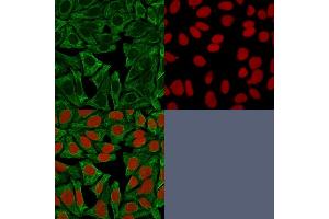 Confocal Immunofluorescence image of HeLa cells using Cytokeratin 18 Mouse Monoclonal Antibody (DE-K18) Green (CF488) and Reddot is used to label the nuclei.