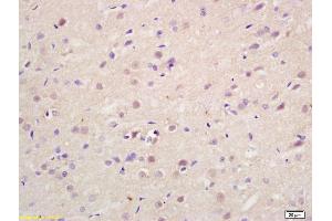 Formalin-fixed and paraffin embedded rat brain labeled with Rabbit Anti Exportin-2 Polyclonal Antibody, Unconjugated (ABIN737331) at 1:200 followed by conjugation to the secondary antibody and DAB staining (Exportin 2 anticorps  (AA 901-971))