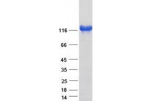 Validation with Western Blot