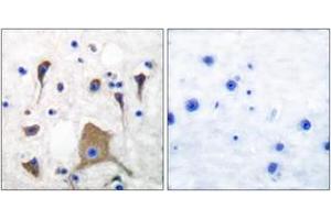 Immunohistochemistry (IHC) image for anti-Glutamate Receptor, Ionotropic, Kainate 1 (GRIK1) (AA 10-59) antibody (ABIN2889205) (GRIK1 anticorps  (AA 10-59))