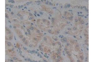 Detection of GPX1 in Human Kidney Tissue using Polyclonal Antibody to Glutathione Peroxidase 1 (GPX1)