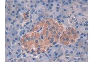 Detection of IL10 in Human Pancreas Tissue using Polyclonal Antibody to Interleukin 10 (IL10) (IL-10 anticorps  (AA 19-178))