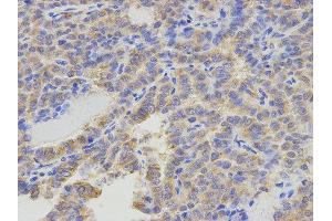 Immunohistochemistry (IHC) image for anti-5-Aminoimidazole-4-Carboxamide Ribonucleotide Formyltransferase/IMP Cyclohydrolase (ATIC) antibody (ABIN1876739) (ATIC anticorps)