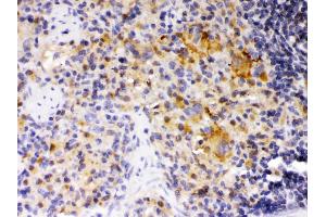 SKAP55 was detected in paraffin-embedded sections of rat spleen tissues using rabbit anti- SKAP55 Antigen Affinity purified polyclonal antibody at 1 μg/mL.