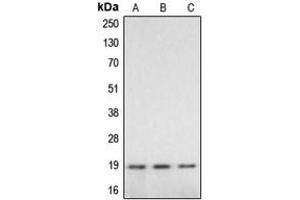 Western blot analysis of Caspase 2 p18 expression in HeLa (A), mouse liver (B), rat liver (C) whole cell lysates. (Caspase 2 p18 anticorps  (Center))