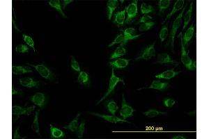 Immunofluorescence of monoclonal antibody to C21orf33 on HeLa cell. (C21orf33 anticorps  (AA 188-268))