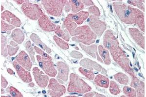 Human Heart (formalin-fixed, paraffin-embedded) stained with CLIC4 antibody ABIN337111 at 5 ug/ml followed by biotinylated anti-goat IgG secondary antibody ABIN481715, alkaline phosphatase-streptavidin and chromogen. (CLIC4 anticorps  (AA 8-20))