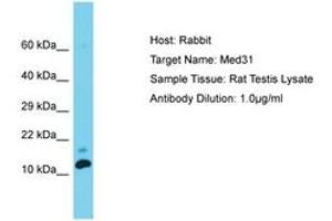 Image no. 1 for anti-Mediator Complex Subunit 31 (MED31) (C-Term) antibody (ABIN6750371) (MED31 anticorps  (C-Term))