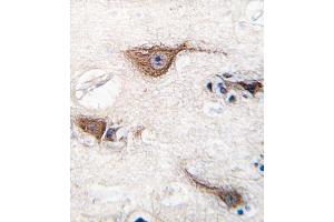 Immunohistochemistry (IHC) image for anti-Ubiquitin Carboxyl-terminal Esterase L1 (Ubiquitin Thiolesterase) (UCHL1) antibody (ABIN3001459) (UCHL1 anticorps)