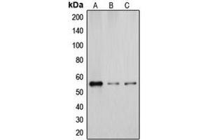 Western blot analysis of Cytochrome P450 2D6 expression in A431 (A), K562 (B), HuvEc (C) whole cell lysates.