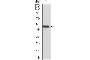 Western blot analysis using KBTBD8 mAb against human KBTBD8 (AA: 264-464) recombinant protein.