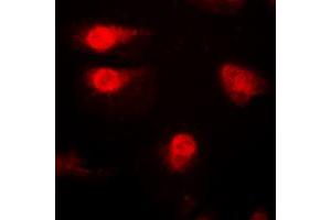 Immunofluorescent analysis of p27 Kip1 (pT187) staining in A431 cells. (CDKN1B anticorps  (C-Term, pSer187))