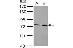 WB Image Sample (20 ug) A: Hela whole cell lysate B: Hela cell membrane 7. (CYP4F2 anticorps  (Internal Region))