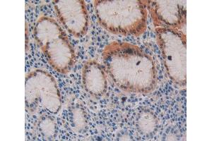 Used in DAB staining on fromalin fixed paraffin- embedded stomach tissue (Fibrillin 3 anticorps  (AA 403-667))