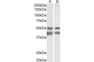 Image no. 1 for anti-E2F Transcription Factor 4, P107/p130-Binding (E2F4) antibody (ABIN5900178) (E2F4 anticorps)