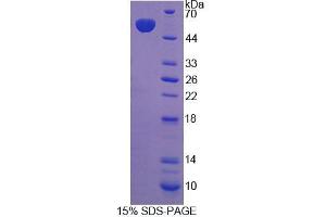 SDS-PAGE analysis of Rabbit HGF Protein. (HGF Protéine)