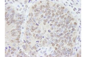 Immunohistochemistry (IHC) image for anti-A Kinase (PRKA) Anchor Protein 8 (AKAP8) (C-Term) antibody (ABIN7448405) (AKAP8 anticorps  (C-Term))