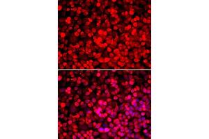 Immunofluorescence analysis of HeLa cells using PUF60 antibody. (PUF60 anticorps  (AA 243-542))